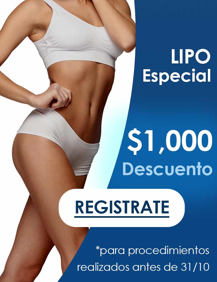 Liposucción Abdominal Precios, Smartlipo Resultados