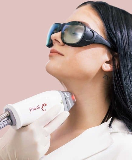 Fraxel laser treatment being performed by our certified laser technician at Infini Cosmetic in Scottsdale