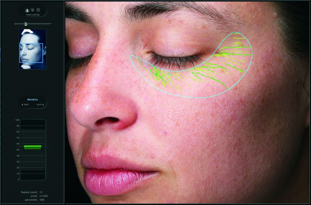 Skin Analysis Results Showing Wrinkle Detection and Skin Texture Mapping