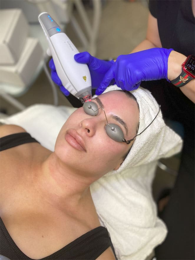 Before and after Clear + Brilliant laser results Phoenix patient showing improved skin texture and glow