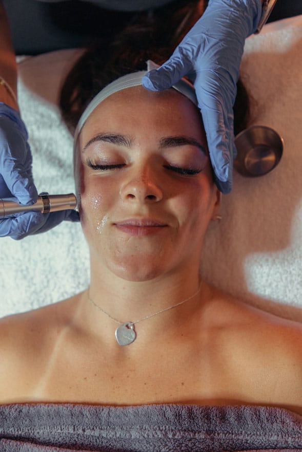 Micro Needling with PRP/Growth