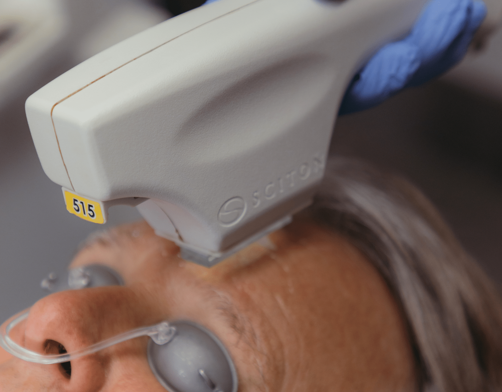 $100 OFF IPL PHOTOFACIAL