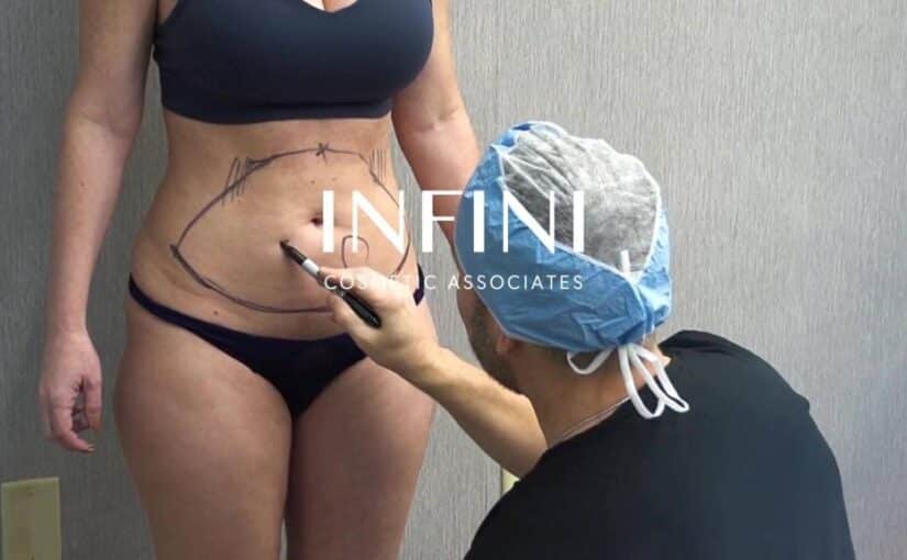 Infini Cosmetic Associates Scottsdale — liposuction and medical aesthetics practice