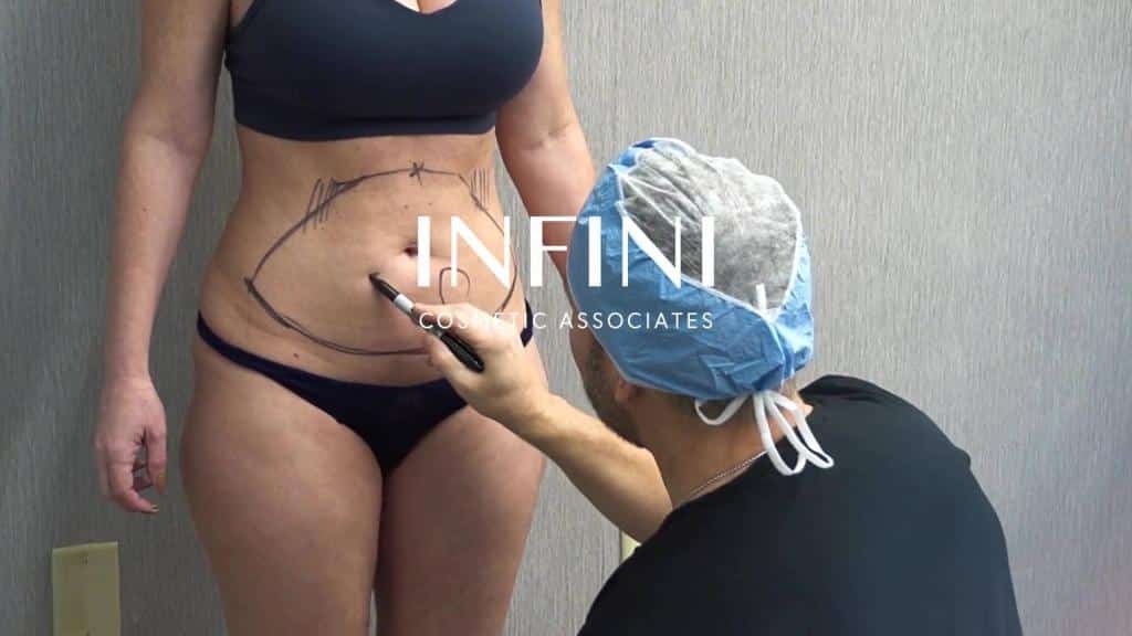 Infini Cosmetic Associates Scottsdale — liposuction and medical aesthetics practice