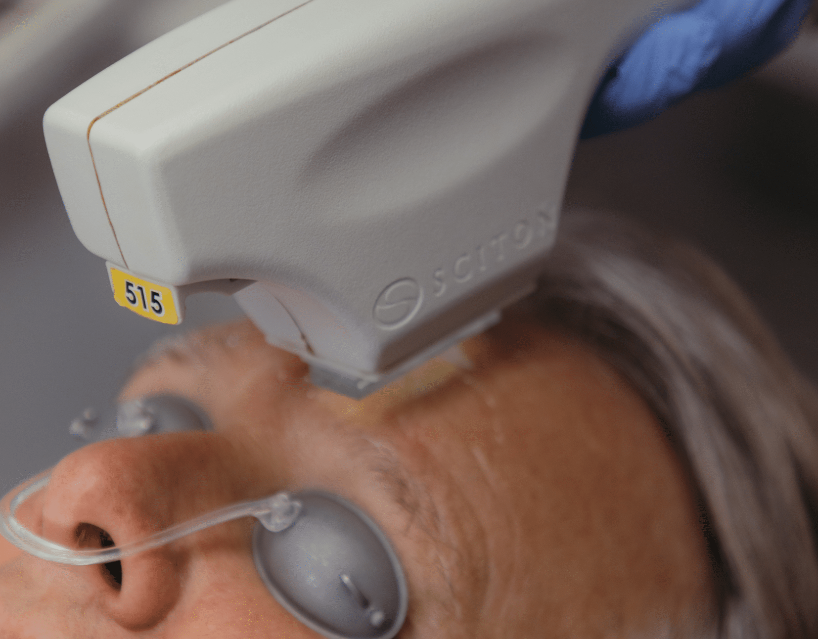 FOTOFACIAL $250