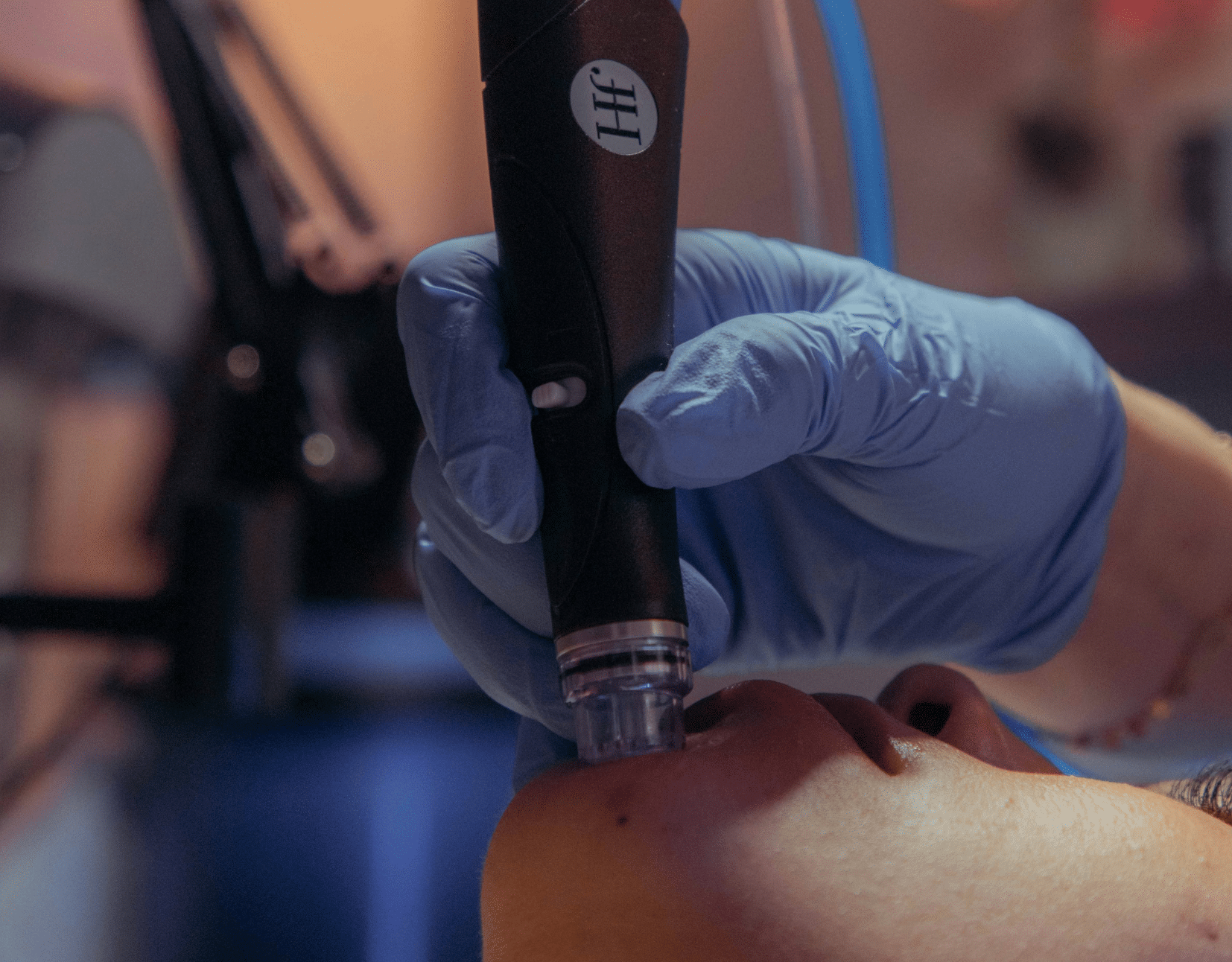 $189 DELUXE HYDRAFACIAL